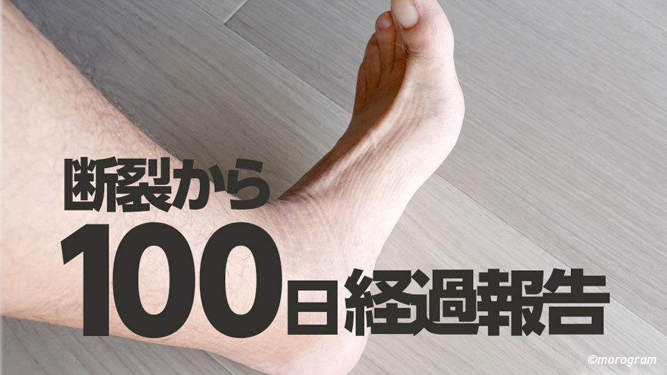 アキレス腱断裂から100日目の経過報告